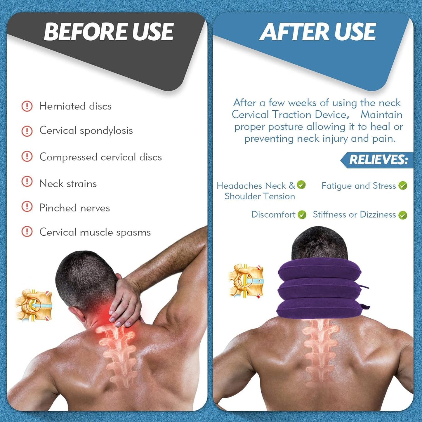 Jaximy Neck Stretcher, Cervical Traction Device, Neck Pain Relief, Adjustable Inflatable Neck Brace& Cervical Pillow, Cervical Neck Traction Device, Cervical Neck Pillow Home Use Decompression(purple)