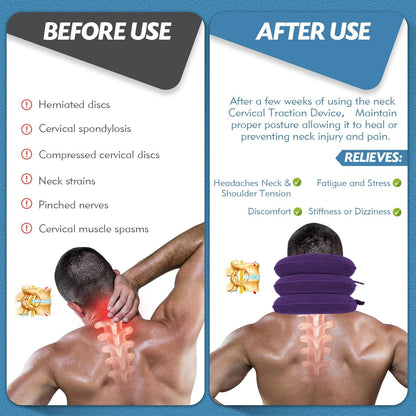 Jaximy Neck Stretcher, Cervical Traction Device, Neck Pain Relief, Adjustable Inflatable Neck Brace& Cervical Pillow, Cervical Neck Traction Device, Cervical Neck Pillow Home Use Decompression(purple)